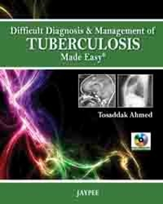 Difficult Diagnosis and Management of Tuberculosis Made Easy - Tosaddak Ahmed