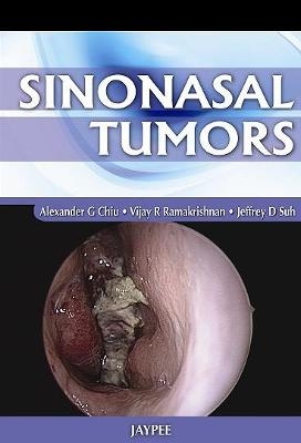 Sinonasal Tumors - Alexander G Chiu, Vijay R Ramakrishnan, Jeffrey D Suh