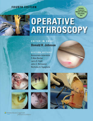 Operative Arthroscopy - Don Johnson, Ned Annuziato Amendola, F Barber, Larry Field, John Richmond