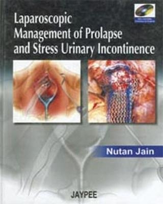 Laparoscopic Management of Prolapse and Stress Urinary Incontinence - Nutan Jain