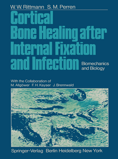 Cortical Bone Healing after Internal Fixation and Infection - W.W. Rittmann, S.M. Perren