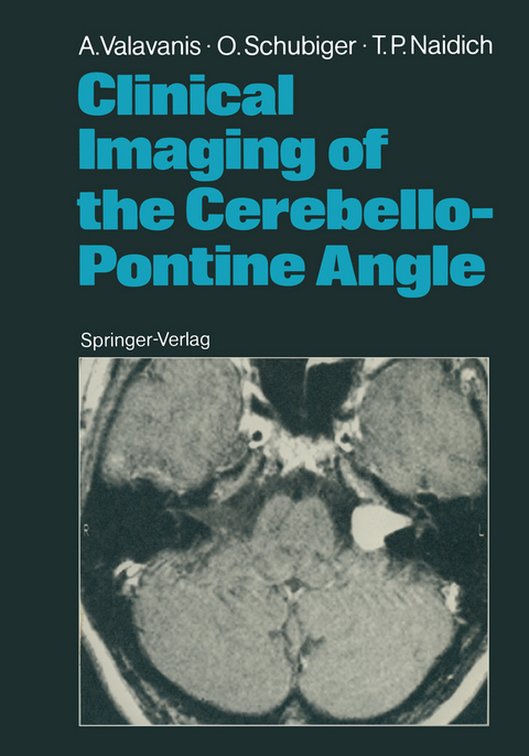 Clinical Imaging of the Cerebello-Pontine Angle - Anton Valavanis, Othmar Schubiger, Thomas P. Naidich