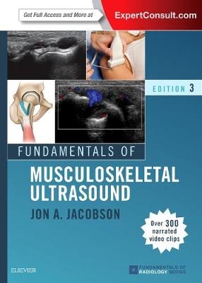 Fundamentals of Musculoskeletal Ultrasound - Jon A. Jacobson