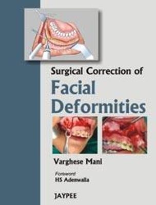 Surgical Correction of Facial Deformities - Varghese Mani