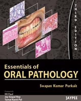 Essentials of Oral Pathology - Swapan Kumar Purkait