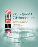 Self-Ligation in Orthodontics - Theodore Eliades, Nikolaos Pandis