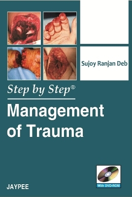 Step by Step: Management of Trauma - Sujoy Ranjan Deb