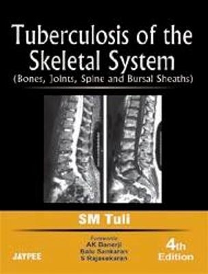 Tuberculosis of the Skeletal System - SM Tuli