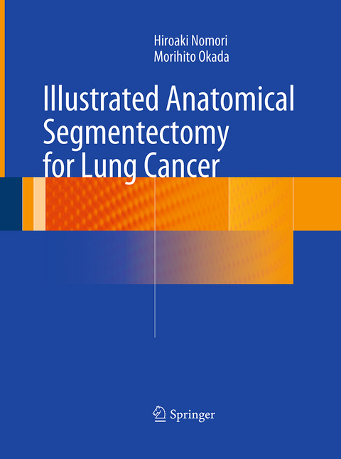 Illustrated Anatomical Segmentectomy for Lung Cancer - Hiroaki Nomori, Morihito Okada