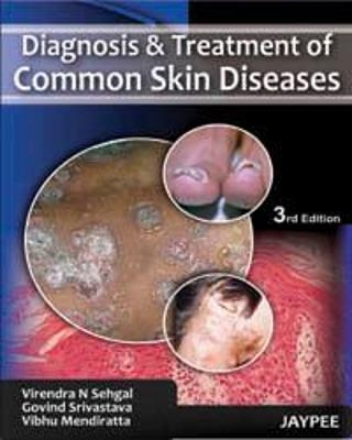 Diagnosis and Treatment of Common Skin Diseases - Virendra N Sehgal, Govind Srivastava, Vibhu Mendiratta