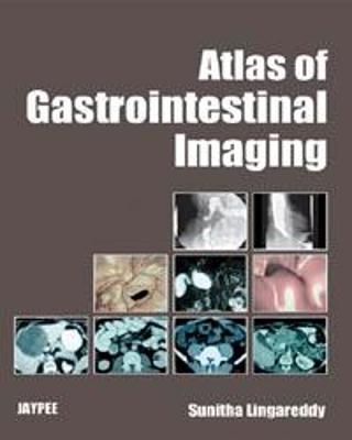 Atlas of Gastrointestinal Imaging - Sunitha Lingareddy