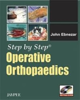 Step by Step: Operative Orthopaedics - John Ebnezar