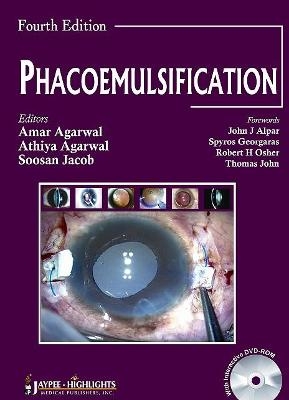 Phacoemulsification, Fourth Edition - Amar Agarwal, Athiya Agarwal, Soosan Jacob