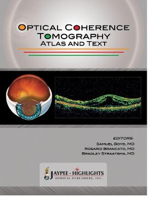 Optical Coherence Tomography - Samuel Boyd, Rosario Brancato, Bradley Straatsma