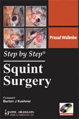 Step by Step: Squint Surgery - Prasad Walimbe