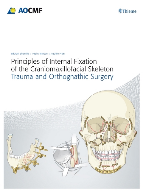 Principles of Internal Fixation of the Craniomaxillofacial Skeleton - Michael Ehrenfeld, Paul N. Manson, Joachim Prein