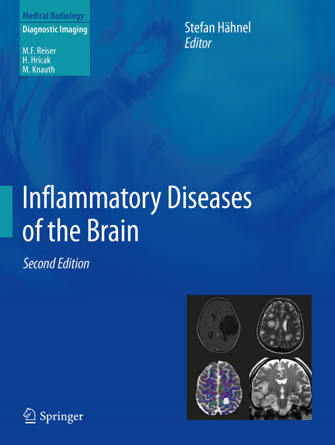 Inflammatory Diseases of the Brain - 