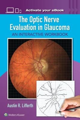 The Optic Nerve Evaluation in Glaucoma - Austin Lifferth