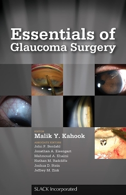 Essentials of Glaucoma Surgery - Malik Y. Kahook