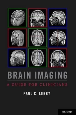 Brain Imaging - Paul C. Lebby