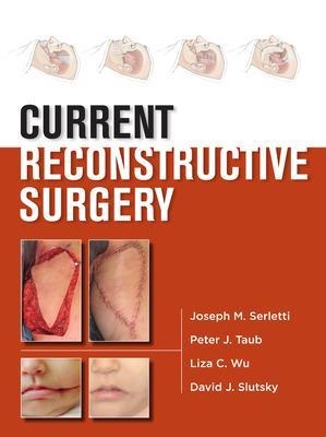 Current Reconstructive Surgery - Joseph Serletti, Peter Taub, Liza Wu, David Slutsky