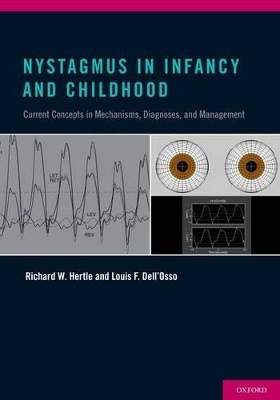 Nystagmus In Infancy and Childhood - Richard W. Hertle, Louis F. Dell'Osso