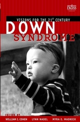 Down Syndrome - 