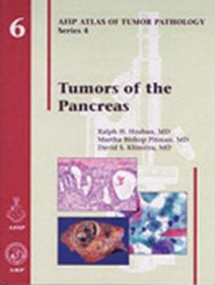 Tumors of the Pancreas - Ralph H. Hruban, Martha Bishop Pitman, David S. Klimstra