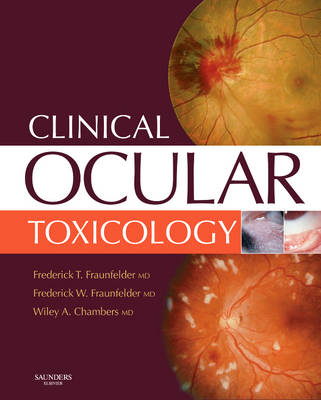 Clinical Ocular Toxicology - Frederick T. Fraunfelder, Frederick W. Fraunfelder, Wiley A. Chambers