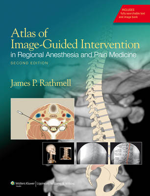 Atlas of Image-Guided Intervention in Regional Anesthesia and Pain Medicine - James P Rathmell,  Rathmell