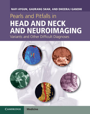 Pearls and Pitfalls in Head and Neck and Neuroimaging - Nafi Aygun, Gaurang Shah, Dheeraj Gandhi