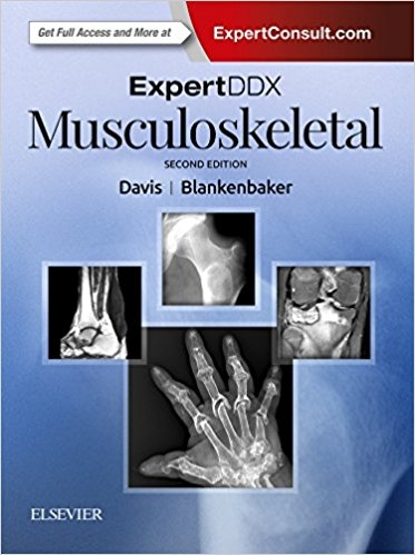 ExpertDDx: Musculoskeletal - Kirkland W. Davis, Donna G Blankenbaker