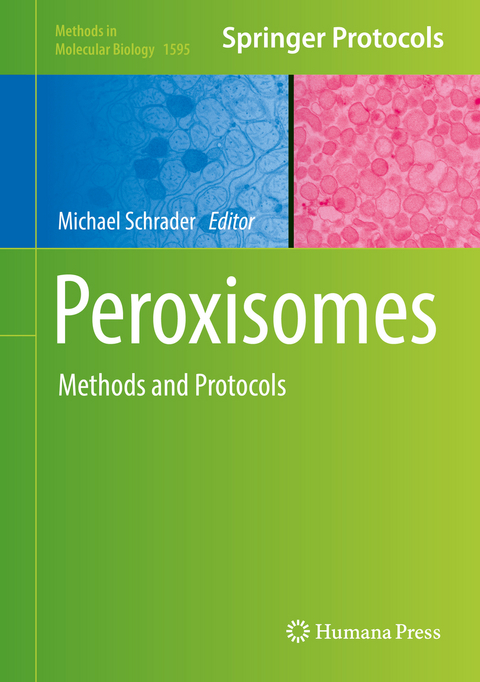 Peroxisomes - 