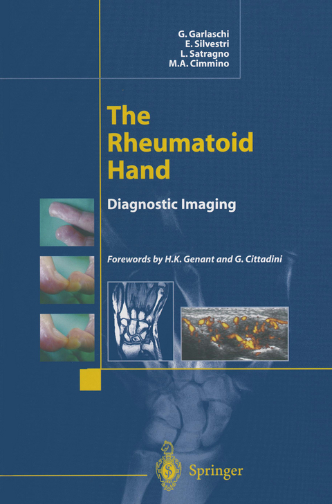 The Rheumatoid Hand - G. Garlaschi, E. Silvestri, L. Satragno