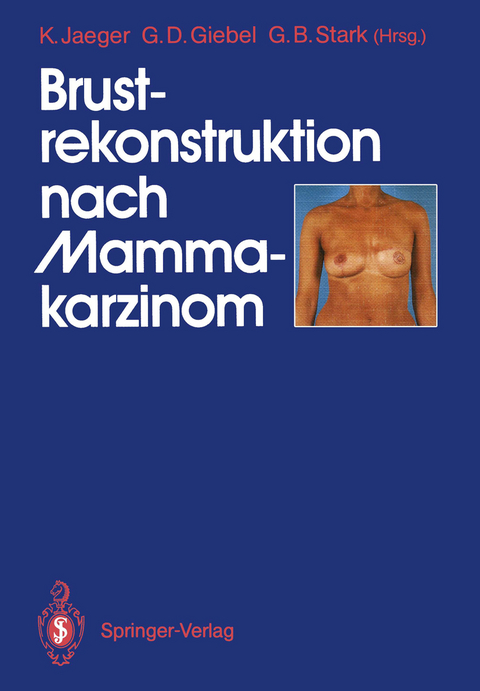 Brustrekonstruktion nach Mammakarzinom - 