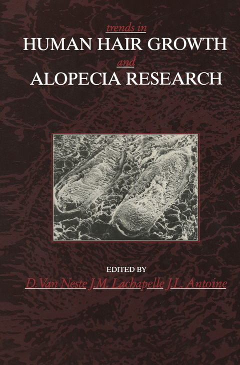 Trends in Human Hair Growth and Alopecia Research - 