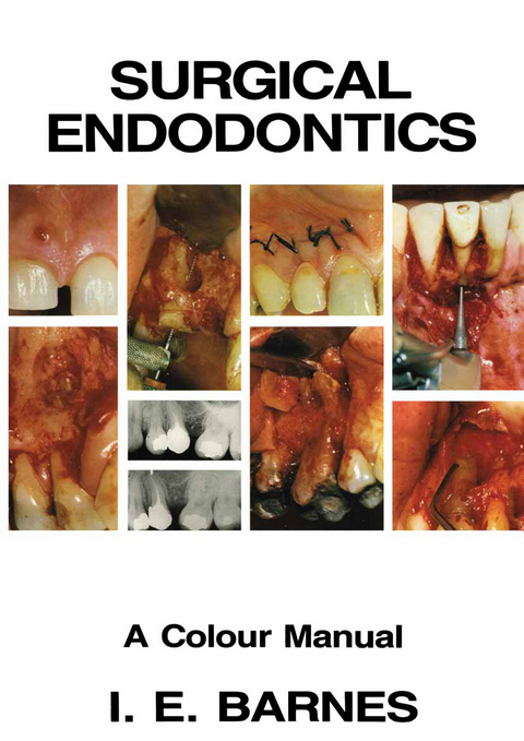 Surgical Endodontics - I. Barnes