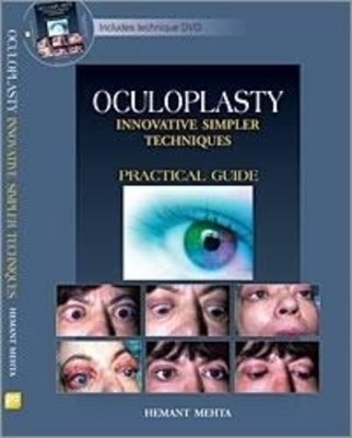 Oculoplasty: Innovative Simpler Techniques - Hemant Kumar Mehta