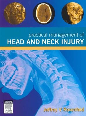 Practical Management of Head and Neck Injury - Jeffrey Rosenfeld