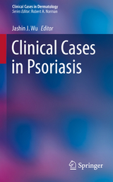 Clinical Cases in Psoriasis - 