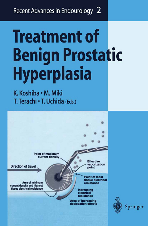 Treatment of Benign Prostatic Hyperplasia - 