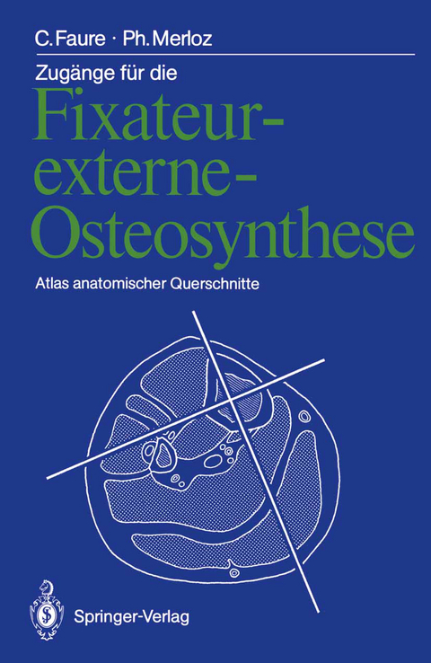 Zugänge für die Fixateur-externe-Osteosynthese - Claude Faure, Philippe Merloz