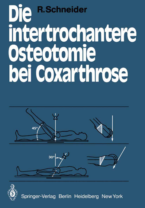 Die intertrochantere Osteotomie bei Coxarthrose - R. Schneider