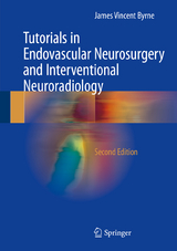 Tutorials in Endovascular Neurosurgery and Interventional Neuroradiology - James Vincent Byrne