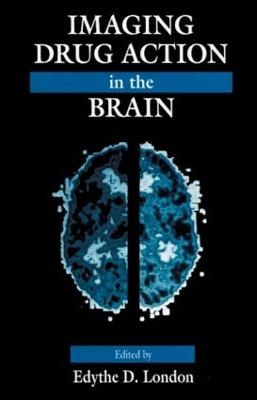 Imaging Drug Action in the Brain - Edythe D. London