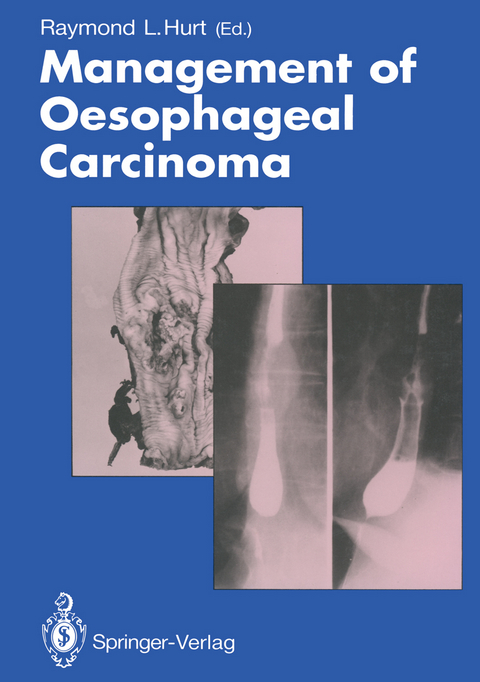 Management of Oesophageal Carcinoma - 