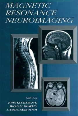 Magnetic Resonance Neuroimaging - John Kucharczyk, A. James Barkovich, Michael Moseley