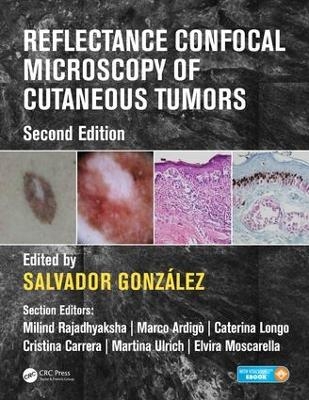 Reflectance Confocal Microscopy of Cutaneous Tumors - 