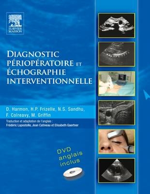 Diagnostic Perioperatoire Et Echographie Interventionnelle + DVD En Anglais - Dominic Harmon, Henry P Frizelle, Navparkash S Sandhu, Frances Colreavy, Michael Griffin