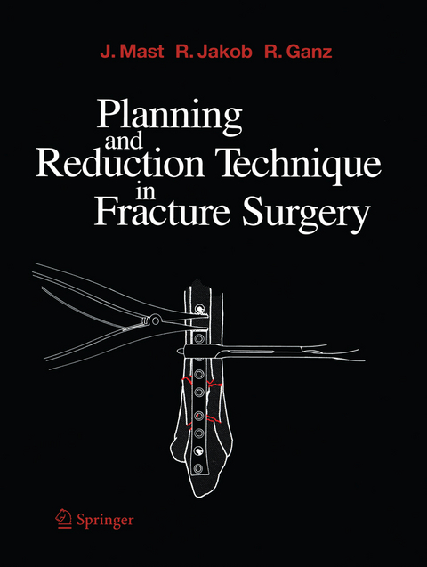 Planning and Reduction Technique in Fracture Surgery - Jeffrey Mast, Roland Jakob, Reinhold Ganz